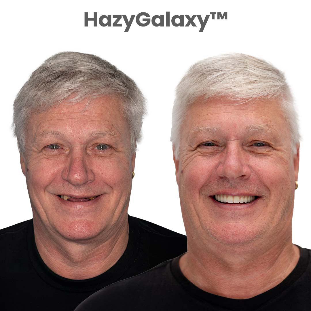 ✨🦷 HazyGalaxy™ Custom-Fit Dentures ⏰ ENDS TODAY 70% OFF | Smile with Confidence