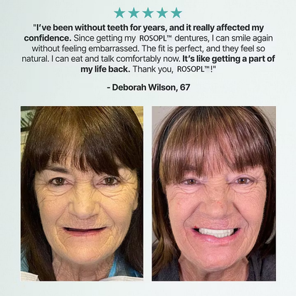 Cheeroll®Custom-Fit Dentures ⏰ ENDS TODAY • 70% OFF | Smile with Confidence
